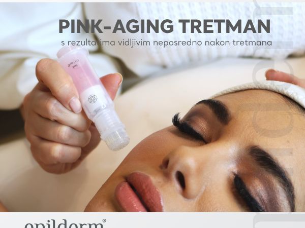 Pink-aging tretman – još učinkovitija vrsta mezoterapije