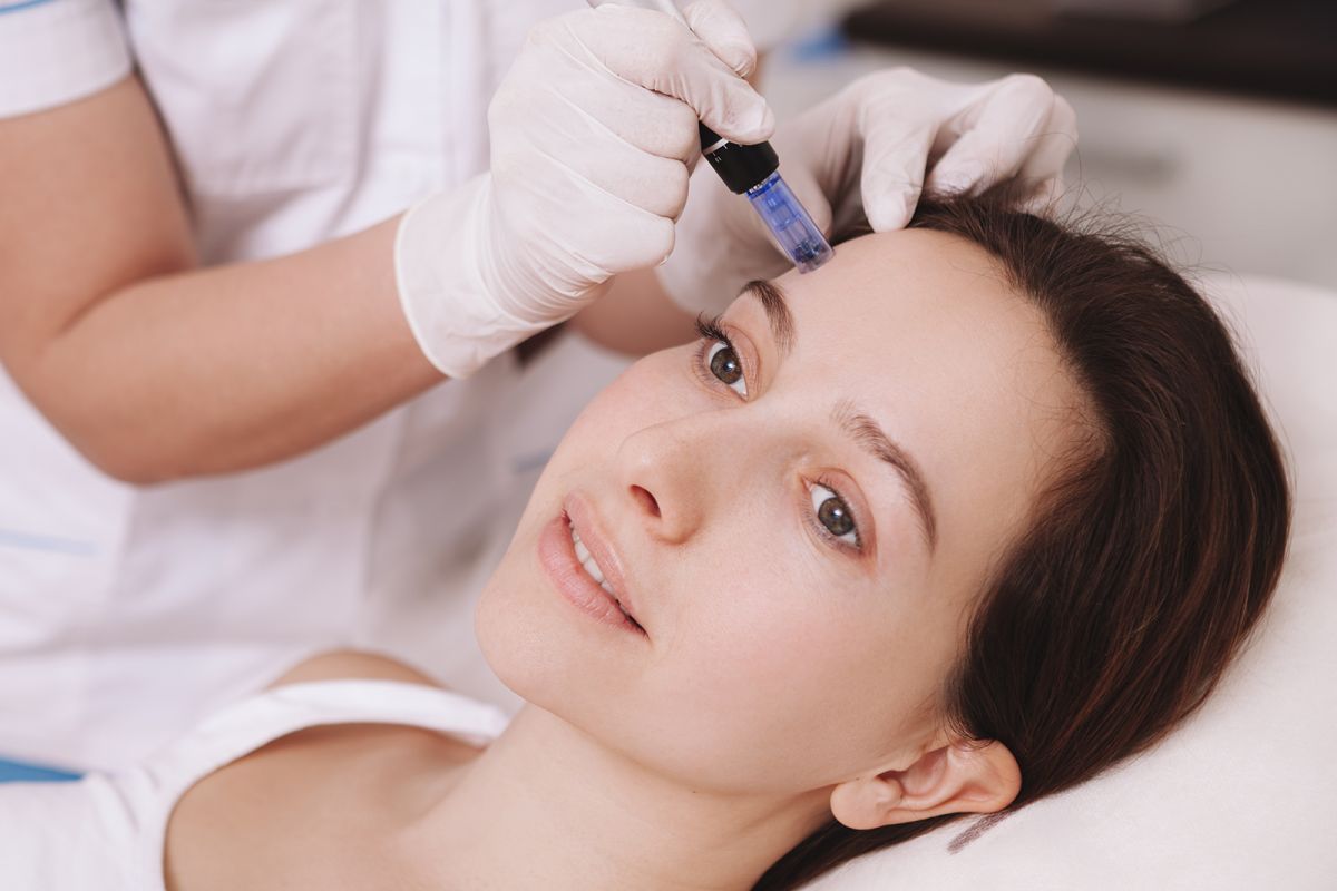 Microneedling Microneedling