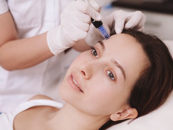 Microneedling Microneedling